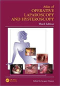 Atlas Of Operative Laparoscopy And Hysteroscopy 3Rd Edition