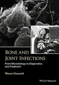 Bone And Joint Infections From Microbiology To Diagnostics And Treatment