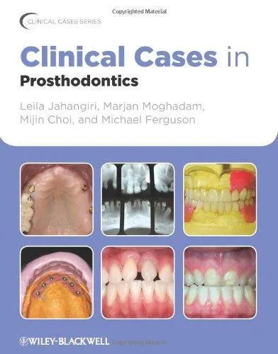 Clinical Cases In Prosthodontics
