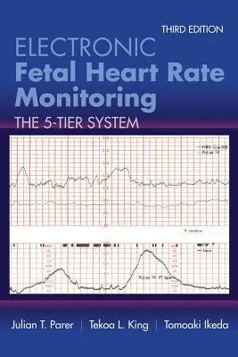 Electronic Fetal Heart Rate Monitoring The 5 Tier System 3Rd Edition