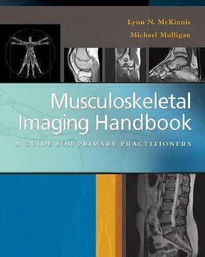 Musculoskeletal Imaging Handbook A Guide To Primary Practitioners