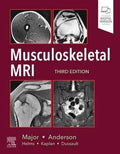 Musculoskeletal Mri 3Rd Edition
