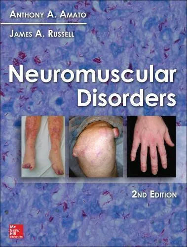 Neuromuscular Disorders 2Nd Edition Amato