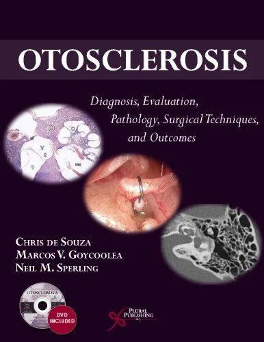 Otosclerosis Diagnosis Evaluation Pathology Surgical Techniques And Outcomes