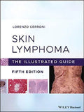 Skin Lymphoma The Illustrated Guide 5Th Edition