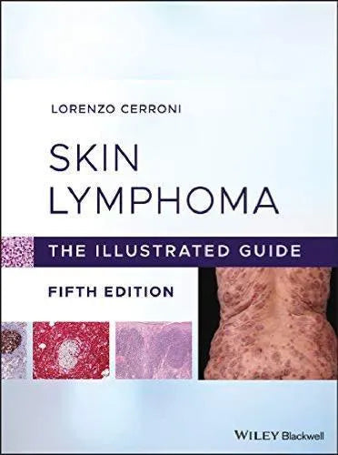 Skin Lymphoma The Illustrated Guide 5Th Edition